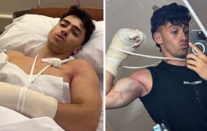 El influencer argentino Gerónimo Arias pierde dos dedos al caer de un acantilado | VIDEO